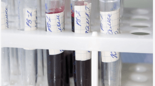 Kinds Of Blood Tests